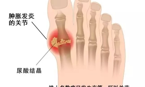 无痛人流需要多少天可以做-【无痛人流要几个月才能做】无痛人流要几个月才能做 - 无痛人流几个月之内可以做网
